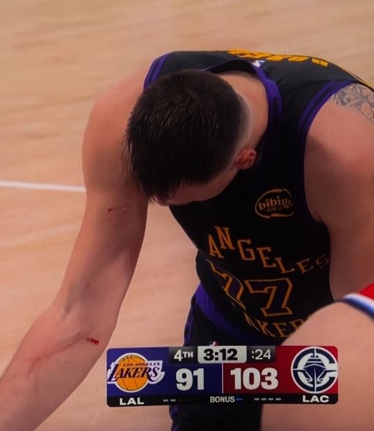 开云app-谁抓的~东契奇罚球时看向手臂 好几道伤口&amp;血迹斑斑